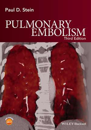 Pulmonary Embolism 3e de PD Stein