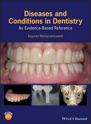 Diseases and Conditions in Dentistry – An Evidence–Based Reference de K Moharamzadeh