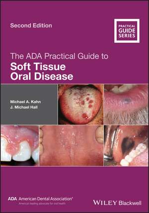 The ADA Practical Guide to Soft Tissue Oral Disease 2e de Kahn