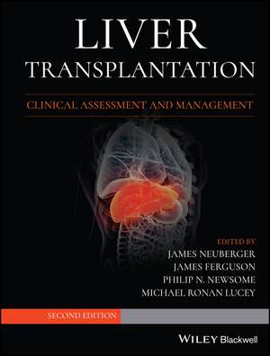 Liver Transplantation de James Neuberger