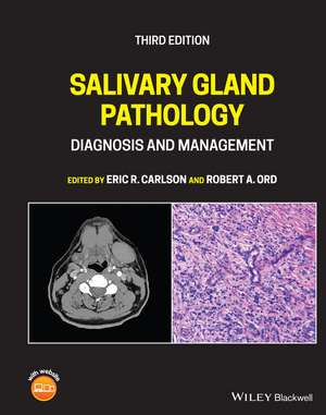 Salivary Gland Pathology – Diagnosis and Management Third Edition de ER Carlson