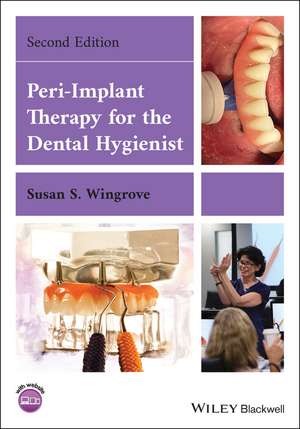 Peri–Implant Therapy for the Dental Hygienist de S Wingrove