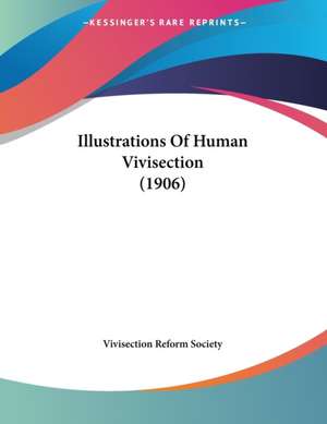 Illustrations Of Human Vivisection (1906) de Vivisection Reform Society