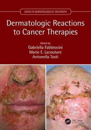 Dermatologic Reactions to Cancer Therapies de Gabriella Fabbrocini