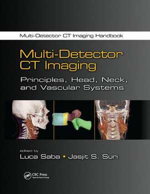 Multi-Detector CT Imaging: Principles, Head, Neck, and Vascular Systems de Luca Saba