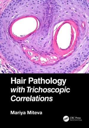 Hair Pathology with Trichoscopic Correlations de Mariya Miteva