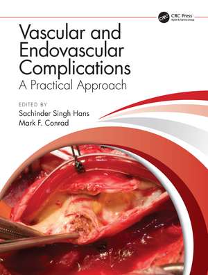 Vascular and Endovascular Complications: A Practical Approach de Sachinder Singh Hans