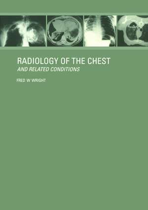 Radiology of the Chest and Related Conditions de F W Wright