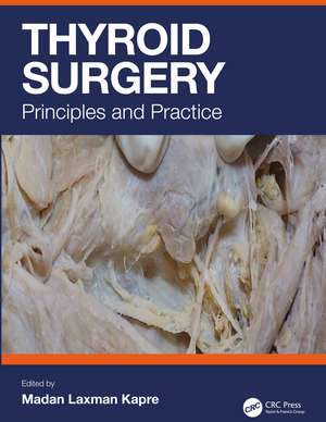 Thyroid Surgery: Principles and Practice de Madan Laxman Kapre