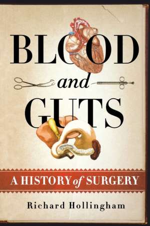 Blood and Guts: A History of Surgery de Richard Hollingham