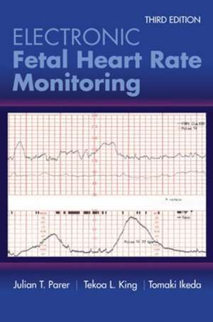 Electronic Fetal Heart Rate Monitoring de Tomoaki Ikeda