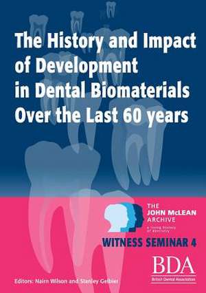 The History and Impact of Development in Dental Biomaterials Over the Last 60 Years de Nairn Wilson