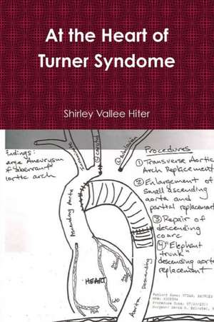 At the Heart of Turner Syndrome de Shirley Vallee Hiter