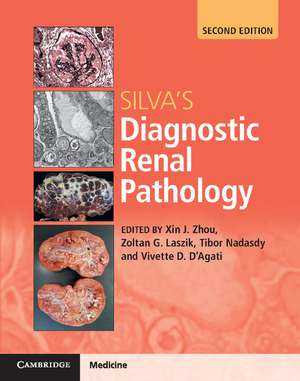 Silva's Diagnostic Renal Pathology de Xin Jin (Joseph) Zhou