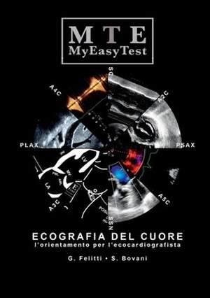 Ecografia del Cuore - Myeasytest de Giuseppe Felitti