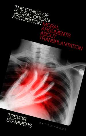 The Ethics of Global Organ Acquisition: Moral Arguments about Transplantation de Trevor Stammers