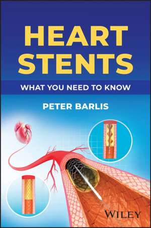 Heart Stents de Peter Barlis