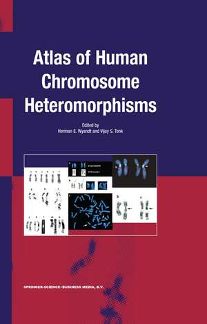 Atlas of Human Chromosome Heteromorphisms de H.E. Wyandt