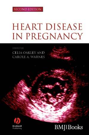 Heart Disease in Pregnancy 2e de C Oakley