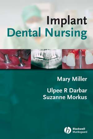 Implant Dental Nursing de M. Miller