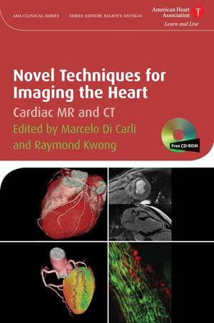 Novel Techniques for Imaging the Heart – Cardiac MR and CT de M Di Carli