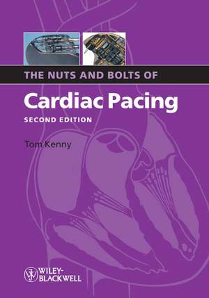 The Nuts and Bolts of Cardiac Pacing 2e de T Kenny