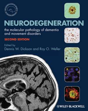 Neurodegeneration – The Molecular Pathology of Dementia and Movement Disorders 2e de D Dickson