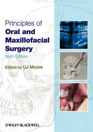 Principles of Oral and Maxillofacial Surgery 6e de UJ Moore