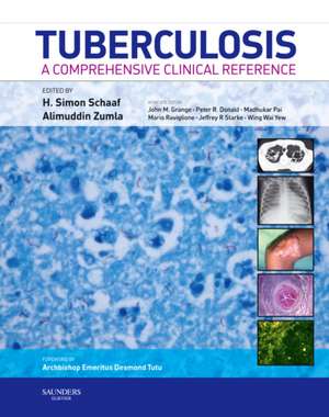 Tuberculosis: A Comprehensive Clinical Reference de H. Simon Schaaf