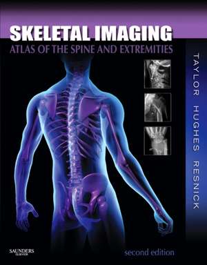 Skeletal Imaging: Atlas of the Spine and Extremities de John A. M. Taylor