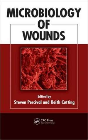 Microbiology of Wounds de Steven Percival