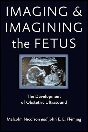 Imaging and Imagining the Fetus – The Development of Obstetric Ultrasound de Malcolm Nicolson