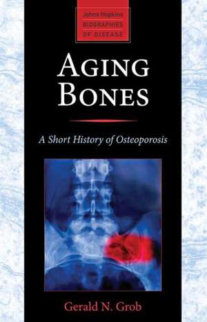 Aging Bones – A Short History of Osteoporosis de Gerald N. Grob