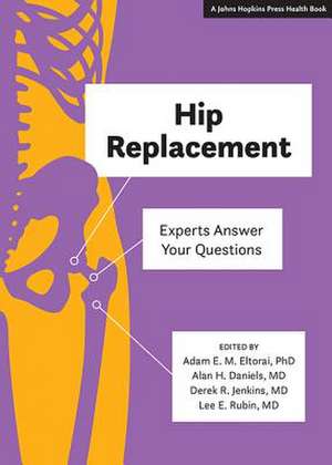 Hip Replacement – Experts Answer Your Questions de Adam E. M. Eltorai