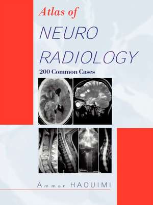 Atlas of Neuroradiology de Ammar Haouimi