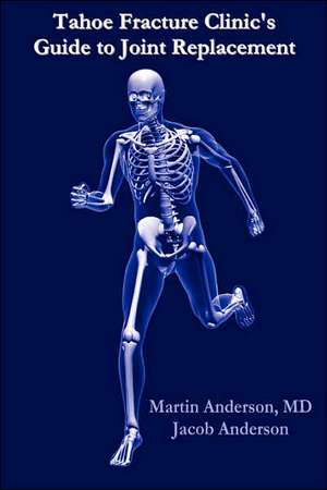 Tahoe Fracture Clinic's Guide to Joint Replacement de Martin Anderson M. D.