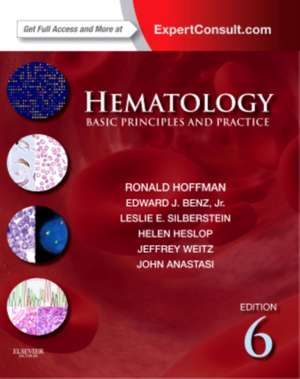 Cartea Hematology: Ronald Hoffman · 9781437729283 | Books Express