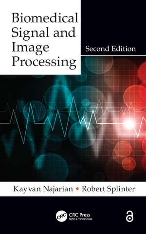 Biomedical Signal and Image Processing de Kayvan Najarian