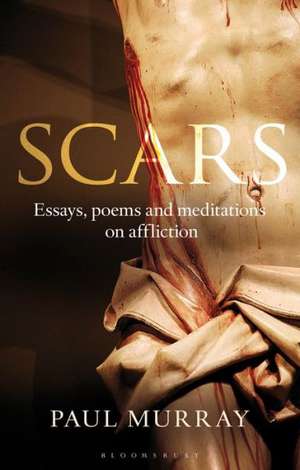 Scars: Essays, Poems and Meditations on Affliction de Dr Paul Murray OP