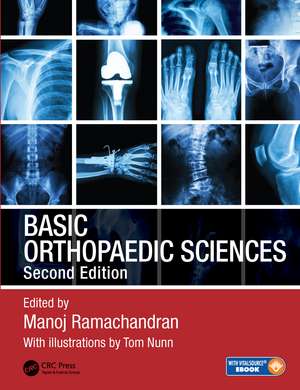 Basic Orthopaedic Sciences de Manoj Ramachandran