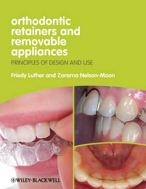 Orthodontic Retainers and Removable Appliances – Principles of Design and Use de K Luther