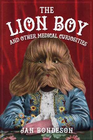 The Lion Boy and Other Medical Curiosities de Jan Bondeson