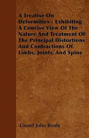 A Treatise On Deformities - Exhibiting A Concise View Of The Nature And Treatment Of The Principal Distortions And Contractions Of Limbs, Joints, And Spine de Lionel John Beale