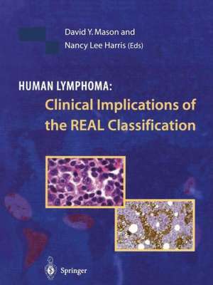 Human Lymphoma: Clinical Implications of the REAL Classification de David Y. Mason