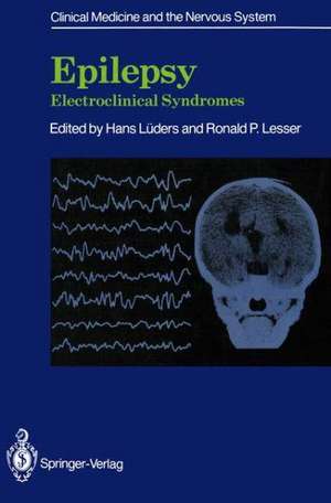 Epilepsy: Electroclinical Syndromes de Hans Lüders