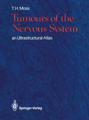 Tumours of the Nervous System: an Ultrastructural Atlas de Timothy H. Moss