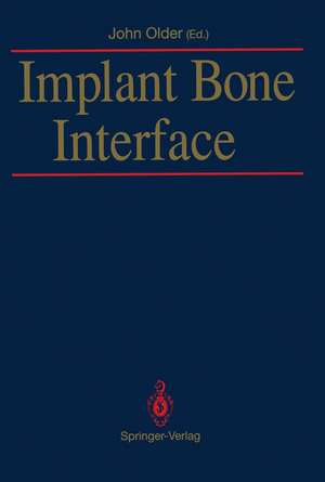 Implant Bone Interface de John Older