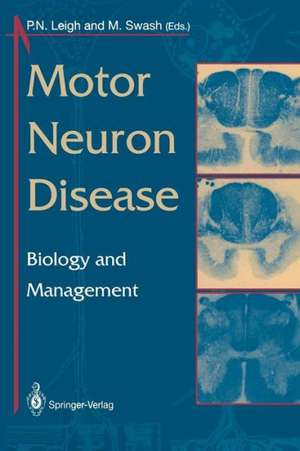 Motor Neuron Disease: Biology and Management de P.N. Leigh