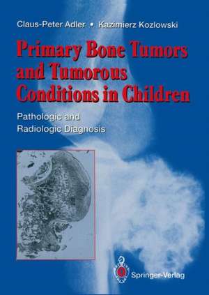 Primary Bone Tumors and Tumorous Conditions in Children: Pathologic and Radiologic Diagnosis de Claus-Peter Adler