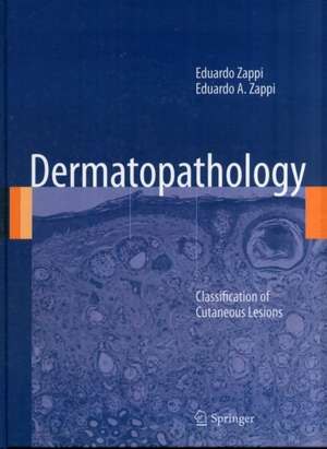 Dermatopathology: Classification of Cutaneous Lesions de Eduardo Zappi